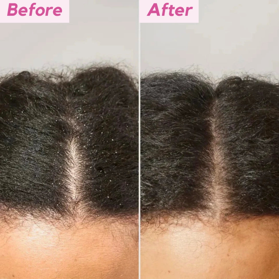 Oaks Detoxing Comb