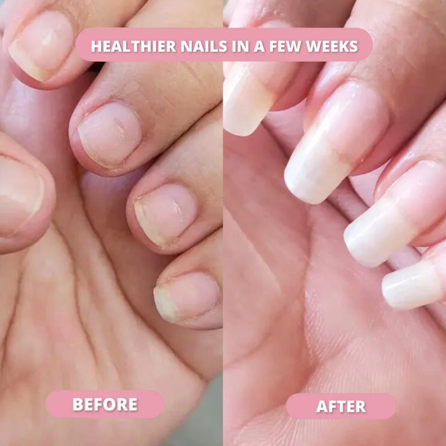 Oaks Nail Growth Pen