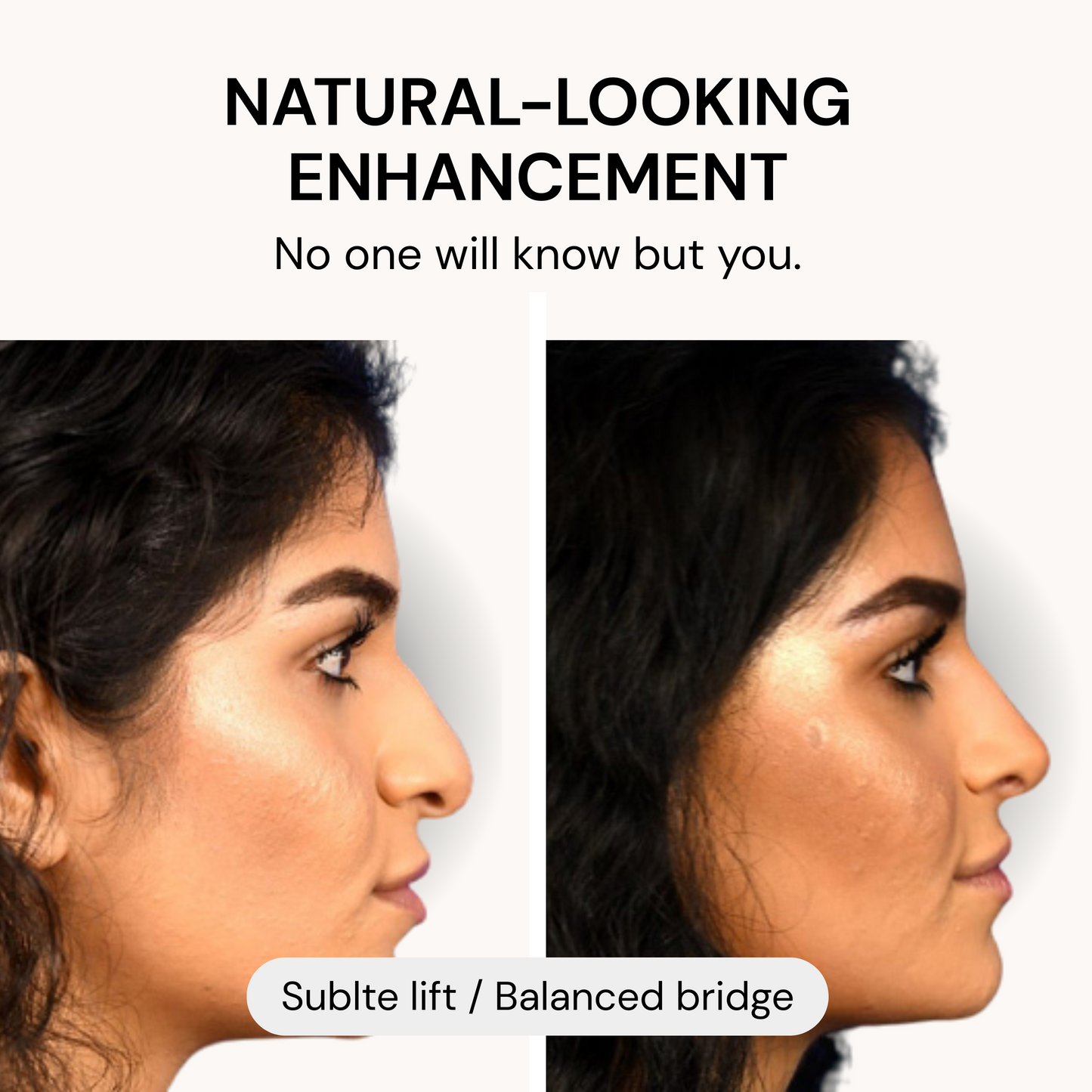 Oaks Instant Nose Lift Kit